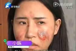 美女主播 砍伤,真相与反思